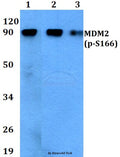 Western blot (WB) analysis of p-MDM2 (S166) polyclonal antibody at 1:500 dilution
Lane1:THP-1 cell lysate treated with EGF(0.1ng/ml,30mins)
Lane2:Raw264.7 cell lysate treated with EGF(0.1ng/ml,30mins)
Lane3:H9C2 cell lysate treated with EGF(0.1ng/ml,30mins)