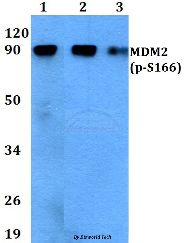 Western blot (WB) analysis of p-MDM2 (S166) polyclonal antibody at 1:500 dilution
Lane1:THP-1 cell lysate treated with EGF(0.1ng/ml,30mins)
Lane2:Raw264.7 cell lysate treated with EGF(0.1ng/ml,30mins)
Lane3:H9C2 cell lysate treated with EGF(0.1ng/ml,30mins)
