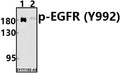 Western blot (WB) analysis of p-EGFR (Y992)) pAb at 1:500 dilution
Lane1:HCC827 whole cell lysate(20ug)
Lane2:A549 whole cell lysate(40ug)