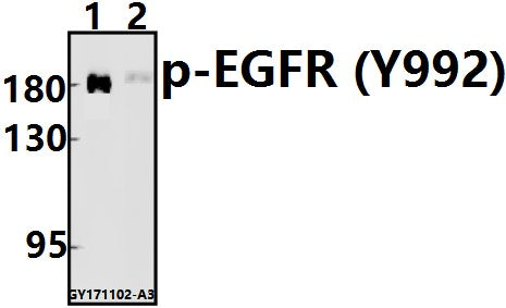Western blot (WB) analysis of p-EGFR (Y992)) pAb at 1:500 dilution
Lane1:HCC827 whole cell lysate(20ug)
Lane2:A549 whole cell lysate(40ug)
