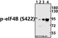 Western blot (WB) analysis of p-eIF4B (S422) pAb at 1:500 dilution
Lane1:The Brain tissue lysate of Rat(40ug)
Lane2:K562 whole cell lysate(40ug)
Lane3:A375 whole cell lysate(40ug)
Lane4:HCT116 whole cell lysate(40ug)
