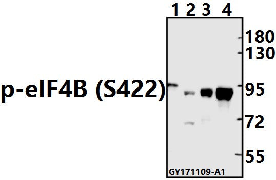 Western blot (WB) analysis of p-eIF4B (S422) pAb at 1:500 dilution
Lane1:The Brain tissue lysate of Rat(40ug)
Lane2:K562 whole cell lysate(40ug)
Lane3:A375 whole cell lysate(40ug)
Lane4:HCT116 whole cell lysate(40ug)