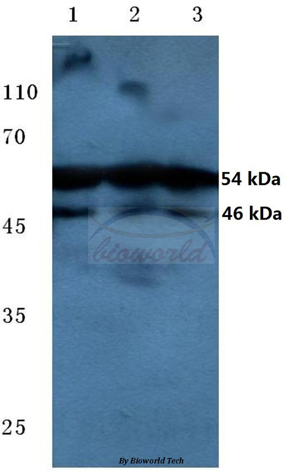 Western blot (WB) analysis of p-JNK1/2/3 (T183/Y185) polyclonal antibody at 1:500 dilution
Lane1:MCF-7 cell lysate treated with UV
Lane2:sp2/0 cell lysate treated with UV
Lane3:PC12 cell lysate treated with UV