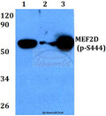 MEF2D (Phospho-S444) polyclonal antibody – Figure 1 of 1