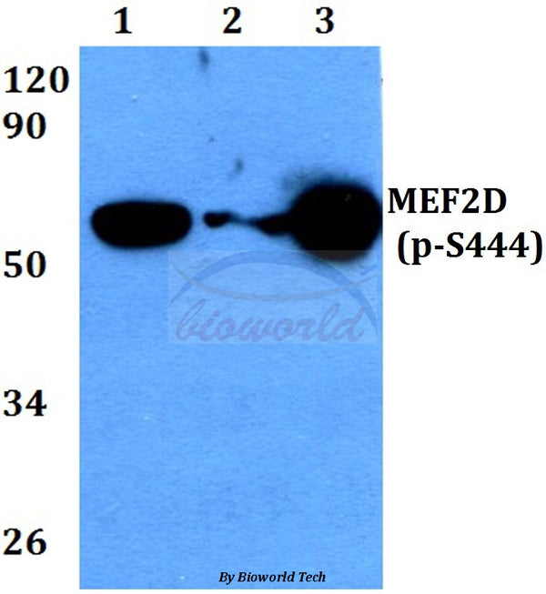 MEF2D (Phospho-S444) polyclonal antibody – Figure 1 of 1