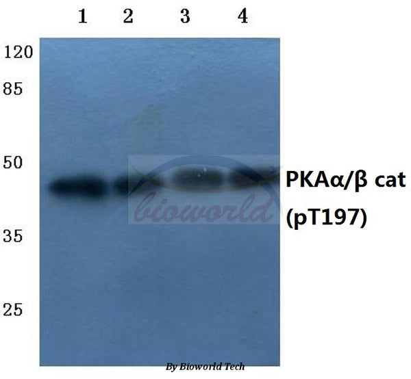 Western blot (WB) analysis of P-PKAα/β cat (T197) pAb at 1:500 dilution
Lane1:HEK293T whole cell lysate(40ug)
Lane2:A549 whole cell lysate(40ug)
Lane3:The Testis tissue lysate of Mouse(40ug)
Lane4:The Testis tissue lysate of Rat(40ug)