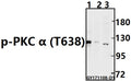 Western blot (WB) analysis of p-PKC α (T638) pAb at 1:500 dilution
Lane1:The Brain tissue lysate of Mouse(40ug)
Lane2:The Brain tissue lysate of Rat(40ug)
Lane3:A549 whole cell lysate(40ug)