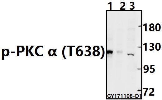 Western blot (WB) analysis of p-PKC α (T638) pAb at 1:500 dilution
Lane1:The Brain tissue lysate of Mouse(40ug)
Lane2:The Brain tissue lysate of Rat(40ug)
Lane3:A549 whole cell lysate(40ug)