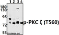 Western blot (WB) analysis of p-PKC ζ (T560) pAb at 1:500 dilution
Lane1:The Brain tissue lysate of Mouse(40ug)
Lane2:The Brain tissue lysate of Rat(40ug)
Lane3:HEK293T whole cell lysate(20ug)
Lane4:PC3 whole cell lysate(20ug)