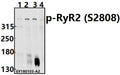 Western blot (WB) analysis of p-RyR2 (S2808) pAb at 1:500 dilution
Lane1:PC3 whole cell lysate(40ug)
Lane2:K562 whole cell lysate(40ug)
Lane3:HEK293T whole cell lysate(40ug)
Lane4:U-87MG whole cell lysate(40ug)