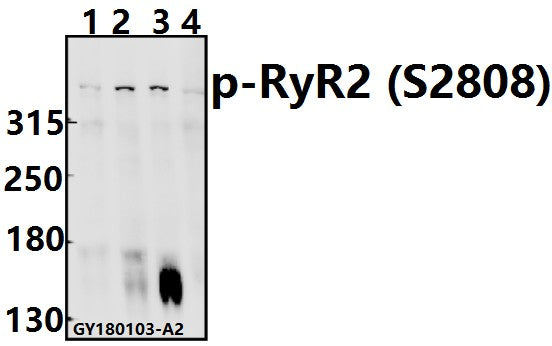 Western blot (WB) analysis of p-RyR2 (S2808) pAb at 1:500 dilution
Lane1:PC3 whole cell lysate(40ug)
Lane2:K562 whole cell lysate(40ug)
Lane3:HEK293T whole cell lysate(40ug)
Lane4:U-87MG whole cell lysate(40ug)