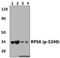 Western blot (WB) analysis of RPS6 (phospho-S240) polyclonal antibody at 1:500 dillution
Lane1:Hela whole cell lysate(40μg)
Lane2:Hela treated with serum starved( 24h) whole cell lysate(40μg)
Lane3:PC12 whole cell lysate(40μg)
Lane4:PC12 treated with serum starved( 24h) whole cell lysate(40μg)