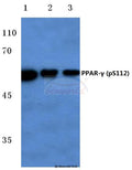 Western blot (WB) analysis of p-PPAR-γ (S112) polyclonal antibody at 1:500 dilution
Lane1:Hela cell lysate treated with colchicine
Lane2:Raw264.7 cell lysate treated with colchicine
Lane3:PC12 cell lysate treated with colchicine
