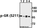 Western blot (WB) analysis of p-GR (S211) pAb at 1:500 dilution
Lane1:SK-OVCAR3 whole cell lysate(40ug)
Lane2:PC12 whole cell lysate(40ug)
Lane3:CT26 whole cell lysate(40ug)
Lane4:SGC7901 whole cell lysate(40ug)