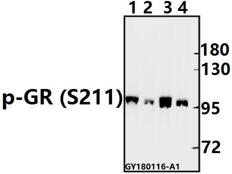 Western blot (WB) analysis of p-GR (S211) pAb at 1:500 dilution
Lane1:SK-OVCAR3 whole cell lysate(40ug)
Lane2:PC12 whole cell lysate(40ug)
Lane3:CT26 whole cell lysate(40ug)
Lane4:SGC7901 whole cell lysate(40ug)
