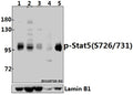 Western blot (WB) analysis of p-Stat5 (S726/731) pAb at 1:500 dilution
Lane1:L02 whole cell lysate(30ug)
Lane2:HepG2 whole cell lysate(40ug)
Lane3:MCF-7 whole cell lysate(40ug)
Lane4:AML-12 whole cell lysate(40ug)
Lane5:PC12 whole cell lysate(40ug)