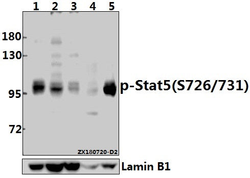 Western blot (WB) analysis of p-Stat5 (S726/731) pAb at 1:500 dilution
Lane1:L02 whole cell lysate(30ug)
Lane2:HepG2 whole cell lysate(40ug)
Lane3:MCF-7 whole cell lysate(40ug)
Lane4:AML-12 whole cell lysate(40ug)
Lane5:PC12 whole cell lysate(40ug)