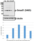 Western blot (WB) analysis of p-Smad1 (S465) pAb at 1:500 dilution
Lane1:A549 whole cell lysate(40ug)
Lane2:A549 treated with UV for 5 minutes then repair for 1 hour whole cell lysate(40ug)
Lane3:A549 treated with UV for 5 minutes then repair for 3 hours whole cell lysate(40ug)
Lane4:A549 treated with UV for 5 minutes then repair for 6 hours whole cell lysate(40ug)
Lane5:A549 treated with UV for 5 minutes then repair for 24 hours whole cell lysate(40ug)
Lane6:The Uterus tissue lysate of Mouse(40