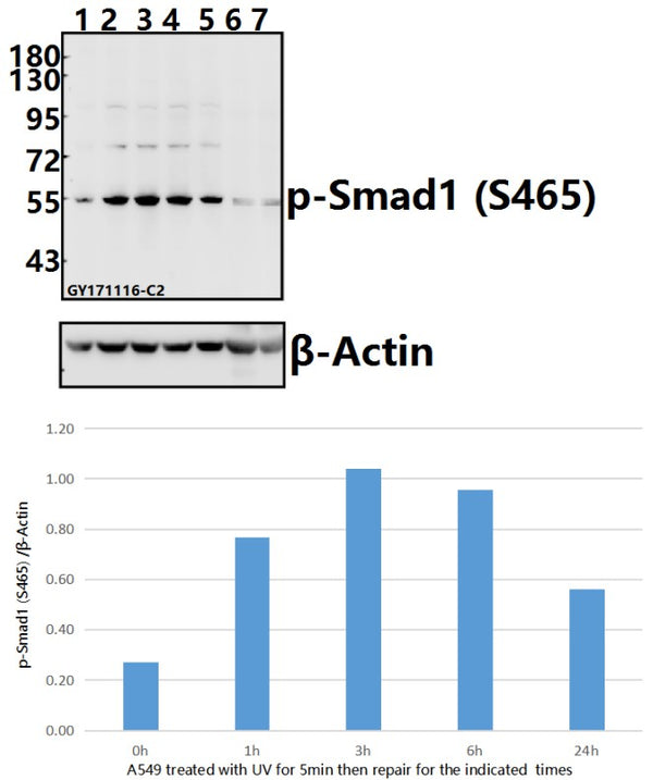 Western blot (WB) analysis of p-Smad1 (S465) pAb at 1:500 dilution
Lane1:A549 whole cell lysate(40ug)
Lane2:A549 treated with UV for 5 minutes then repair for 1 hour whole cell lysate(40ug)
Lane3:A549 treated with UV for 5 minutes then repair for 3 hours whole cell lysate(40ug)
Lane4:A549 treated with UV for 5 minutes then repair for 6 hours whole cell lysate(40ug)
Lane5:A549 treated with UV for 5 minutes then repair for 24 hours whole cell lysate(40ug)
Lane6:The Uterus tissue lysate of Mouse(40