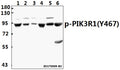 Western blot (WB) analysis of PI3K p85α/p55γ (phospho-Y467/Y199) polyclonal antibody at 1:500 dilution
Lane1:COS-7 whole cell lysate(40ug)
Lane2:H1792 whole cell lysate(40ug)
Lane3:MG63 whole cell lysate(40ug)
Lane4:The Brain tissue lysate of Rat(40ug)
Lane5:MEF whole cell lysate(40ug)
Lane6:The Heart tissue lysate of Rat(40ug)