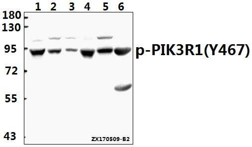 Western blot (WB) analysis of PI3K p85α/p55γ (phospho-Y467/Y199) polyclonal antibody at 1:500 dilution
Lane1:COS-7 whole cell lysate(40ug)
Lane2:H1792 whole cell lysate(40ug)
Lane3:MG63 whole cell lysate(40ug)
Lane4:The Brain tissue lysate of Rat(40ug)
Lane5:MEF whole cell lysate(40ug)
Lane6:The Heart tissue lysate of Rat(40ug)