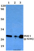 Western blot (WB) analysis of Snail1 (phospho-S246) polyclonal antibody at 1:500 dilution
Lane1:MCF-7 whole cell lysate
Lane2:Raw264.7 whole cell lysate
Lane3:PC12 whole cell lysate