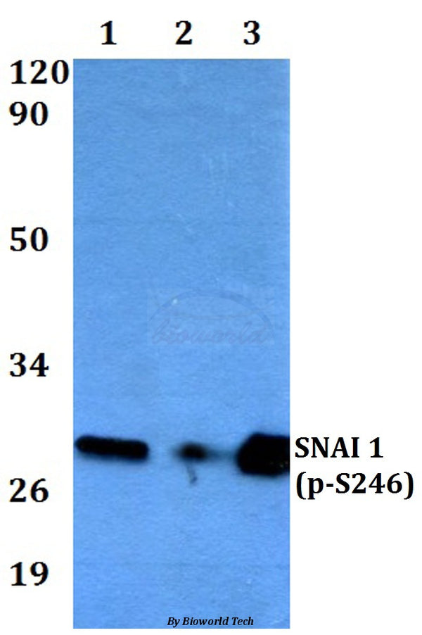 Western blot (WB) analysis of Snail1 (phospho-S246) polyclonal antibody at 1:500 dilution
Lane1:MCF-7 whole cell lysate
Lane2:Raw264.7 whole cell lysate
Lane3:PC12 whole cell lysate