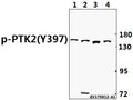 Western blot (WB) analysis of FAK (phospho-Y397) polyclonal antibody at 1:500 dilution
Lane1:CT26 whole cell lysate(40ug)
Lane2:PC12 whole cell lysate(40ug)
Lane3:A549 whole cell lysate(40ug)
Lane4:H1792 whole cell lysate(40ug)