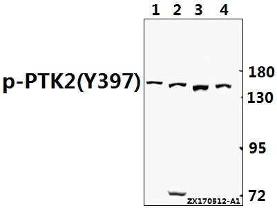 Western blot (WB) analysis of FAK (phospho-Y397) polyclonal antibody at 1:500 dilution
Lane1:CT26 whole cell lysate(40ug)
Lane2:PC12 whole cell lysate(40ug)
Lane3:A549 whole cell lysate(40ug)
Lane4:H1792 whole cell lysate(40ug)