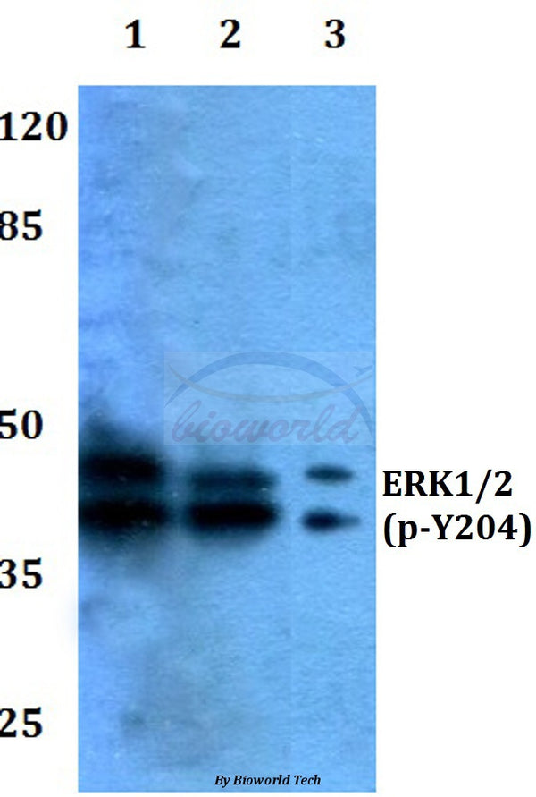 Western blot (WB) analysis of p-ERK1/2 (Y204) polyclonal antibody at 1:500 dilution
Lane1:HEK293T whole cell lysate treated with PMA(100nM,15mins)
Lane2:sp2/0 whole cell lysate treated with PMA(100nM,15mins)
Lane3:PC12 whole cell lysate treated with PMA(100nM,15mins)