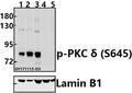 Western blot (WB) analysis of p-PKC δ (S645) pAb at 1:500 dilution
Lane1:A549 whole cell lysate(20ug)
Lane2:HCT116 whole cell lysate(20ug)
Lane3:SGC7901 whole cell lysate(40ug)
Lane4:The Uterus tissue lysate of Mouse(40ug)
Lane5:The Uterus tissue lysate of Rat(40ug)