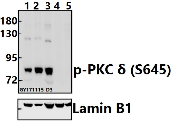 Western blot (WB) analysis of p-PKC δ (S645) pAb at 1:500 dilution
Lane1:A549 whole cell lysate(20ug)
Lane2:HCT116 whole cell lysate(20ug)
Lane3:SGC7901 whole cell lysate(40ug)
Lane4:The Uterus tissue lysate of Mouse(40ug)
Lane5:The Uterus tissue lysate of Rat(40ug)
