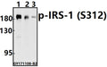 Western blot (WB) analysis of p-IRS-1 (S312) pAb at 1:500 dilution
Lane1:PC3 whole cell lysate(40ug)
Lane2:SGC7901 whole cell lysate(40ug)
Lane3:MCF-71 whole cell lysate(40ug)