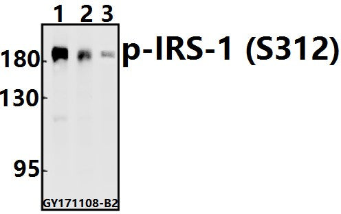 Western blot (WB) analysis of p-IRS-1 (S312) pAb at 1:500 dilution
Lane1:PC3 whole cell lysate(40ug)
Lane2:SGC7901 whole cell lysate(40ug)
Lane3:MCF-71 whole cell lysate(40ug)