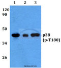 Western blot (WB) analysis of p-p38 (T180) polyclonal antibody at 1:500 dilution
Lane1:HEK293T cell lysate treated with UV(4h)
Lane2:Raw264.7 cell lysate treated with UV(4h)
Lane3:PC12 cell lysate treated with UV(4h)