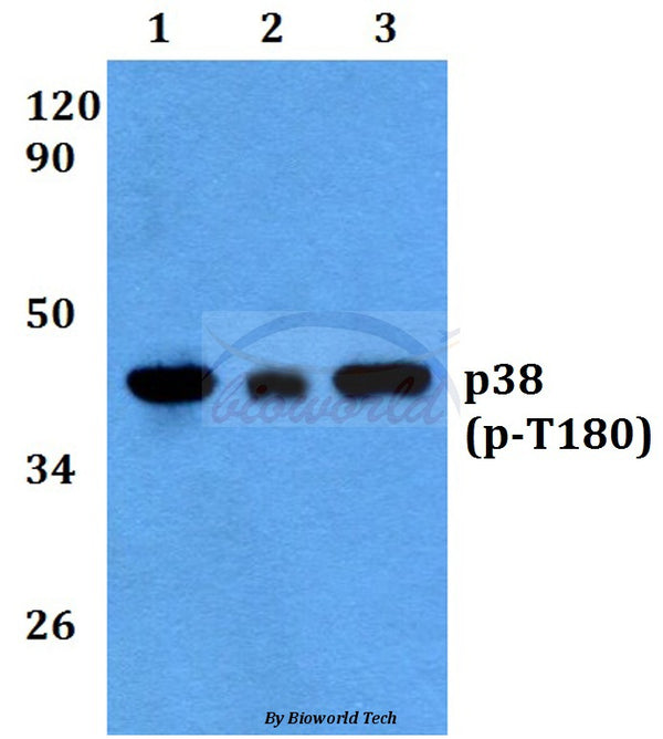 Western blot (WB) analysis of p-p38 (T180) polyclonal antibody at 1:500 dilution
Lane1:HEK293T cell lysate treated with UV(4h)
Lane2:Raw264.7 cell lysate treated with UV(4h)
Lane3:PC12 cell lysate treated with UV(4h)