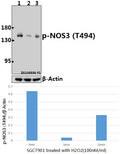 Western blot (WB) analysis of p-NOS3 (T494) pAb at 1:1000 dilution
Lane1:SGC7901 whole cell lysate(40ug)
Lane2:SGC7901 treated with H2O2(100nM/ml,5 minutes) whole cell lysate(40ug)
Lane3:SGC7901 treated with H2O2(100nM/ml,10 minutes) whole cell lysate(40ug)