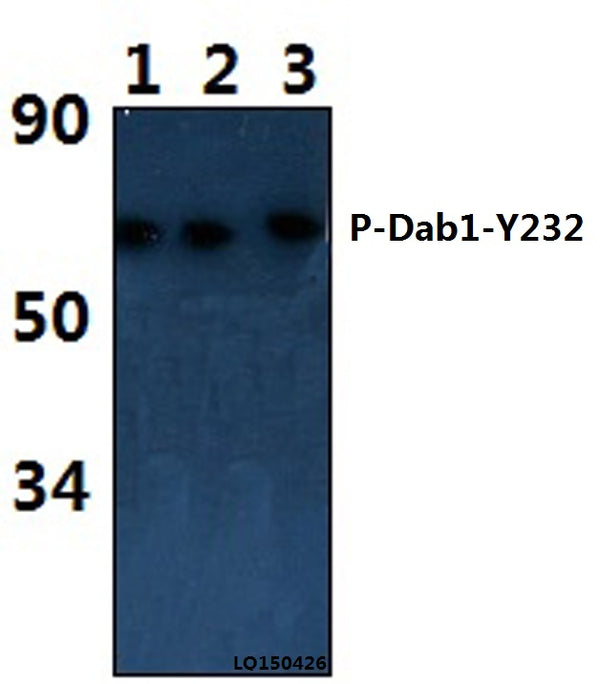 Western blot (WB) analysis of Dab1 (phospho-Y232) polyclonal antibody at 1:1000 dilution   Lane1:LO2 whole cell lysate(38ug)      Lane2:The Brain tissue lysate of Rat(44ug)  Lane3:The Brain tissue lysate of Mouse(39ug)