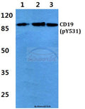 Western blot (WB) analysis of p-CD19 (Y531) polyclonal antibody at 1:500 dilution
Lane1:Hela cell lysate treated with EGF(0.1ng/ML,30mins)
Lane2:Raw264.7 cell lysate treated with EGF(0.1ng/ML,30mins)
Lane3:H9C2 cell lysate treated with EGF(0.1ng/ML,30mins)
