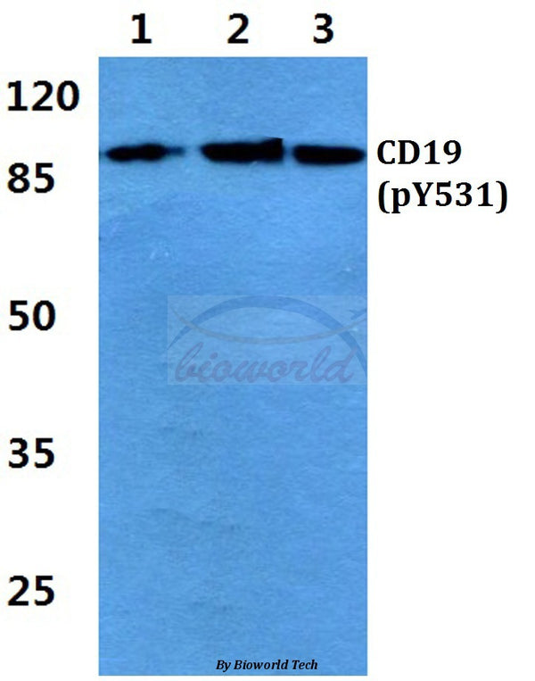 Western blot (WB) analysis of p-CD19 (Y531) polyclonal antibody at 1:500 dilution
Lane1:Hela cell lysate treated with EGF(0.1ng/ML,30mins)
Lane2:Raw264.7 cell lysate treated with EGF(0.1ng/ML,30mins)
Lane3:H9C2 cell lysate treated with EGF(0.1ng/ML,30mins)