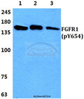 Western blot (WB) analysis of p-FGFR1 (Y654) polyclonal antibody at 1:500 dilution
Lane1:HEK293T cell lysate
Lane2:Raw264.7 cell lysate
Lane3:PC12 cell lysate