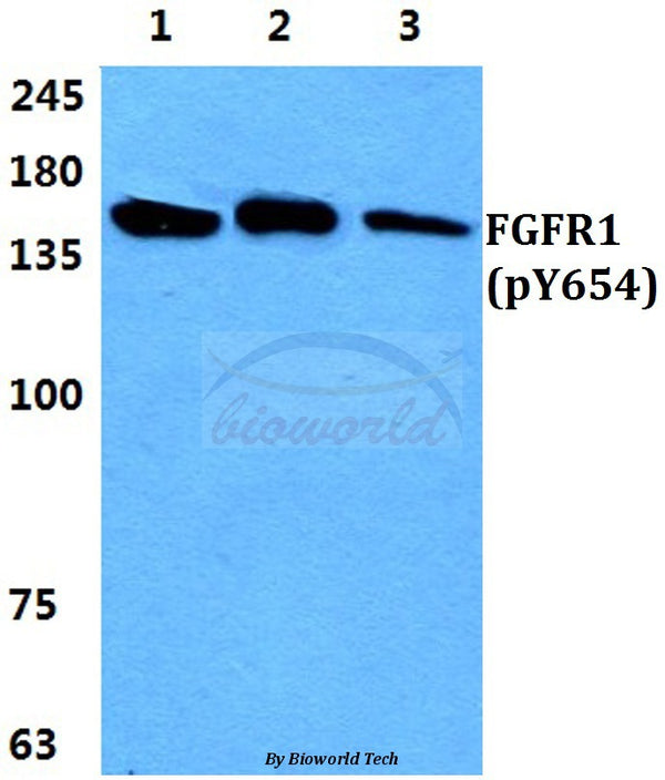 Western blot (WB) analysis of p-FGFR1 (Y654) polyclonal antibody at 1:500 dilution
Lane1:HEK293T cell lysate
Lane2:Raw264.7 cell lysate
Lane3:PC12 cell lysate