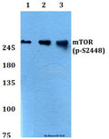 Western blot (WB) analysis of p-mTOR (S2448) polyclonal antibody at 1:500 dilution
Lane1:HEK293T cell lysate treated with insulin(100nM,30mins)
Lane2:Raw264.7 cell lysate treated with insulin(100nM,30mins)
Lane3:PC12 cell lysate treated with insulin(100nM,30mins)