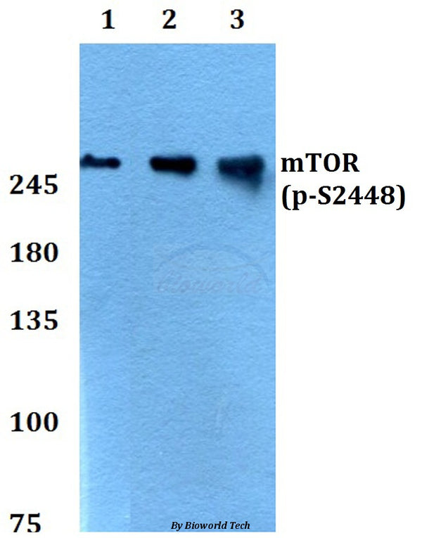 Western blot (WB) analysis of p-mTOR (S2448) polyclonal antibody at 1:500 dilution
Lane1:HEK293T cell lysate treated with insulin(100nM,30mins)
Lane2:Raw264.7 cell lysate treated with insulin(100nM,30mins)
Lane3:PC12 cell lysate treated with insulin(100nM,30mins)