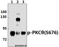 Western blot (WB) analysis of p-PKC θ (S676) pAb at 1:500 dilution
Lane1:The Spleen tissue lysate of Mouse(40ug)
Lane2:K562 whole cell lysate(40ug)
Lane3:The Thymus tissue lysate of Rat(40ug)