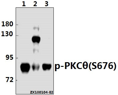 Western blot (WB) analysis of p-PKC θ (S676) pAb at 1:500 dilution
Lane1:The Spleen tissue lysate of Mouse(40ug)
Lane2:K562 whole cell lysate(40ug)
Lane3:The Thymus tissue lysate of Rat(40ug)