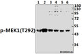 Western blot (WB) analysis of p-MEK1 (T292) pAb at 1:500 dilution
Lane1:CT26 whole cell lysate(40ug)
Lane2:H9C2 whole cell lysate(40ug)
Lane3:A2780 whole cell lysate(40ug)
Lane4:H1792 whole cell lysate(40ug)
Lane5:SGC7901 whole cell lysate(40ug)
Lane6:A549 whole cell lysate(40ug)