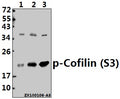 Western blot (WB) analysis of p-Cofilin (S3) pAb at 1:500 dilution
Lane1:SGC7901 whole cell lysate(40ug)
Lane2:HCT116 whole cell lysate(40ug)
Lane3:A549 whole cell lysate(40ug)