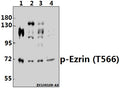 Western blot (WB) analysis of p-Ezrin (T566) pAb at 1:500 dilution
Lane1:HEK293T whole cell lysate(40ug)
Lane2:U-87MG whole cell lysate(40ug)
Lane3:A2780 whole cell lysate(40ug)
Lane4:SGC7901 whole cell lysate(40ug)