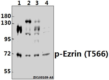 Western blot (WB) analysis of p-Ezrin (T566) pAb at 1:500 dilution
Lane1:HEK293T whole cell lysate(40ug)
Lane2:U-87MG whole cell lysate(40ug)
Lane3:A2780 whole cell lysate(40ug)
Lane4:SGC7901 whole cell lysate(40ug)